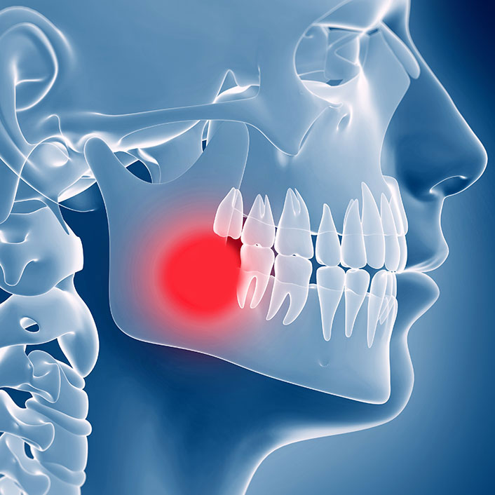 TMJ Treatment - Dental Services